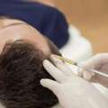 Advanced Hair Fall & Loss PRP Treatment In Bannerghatta Road