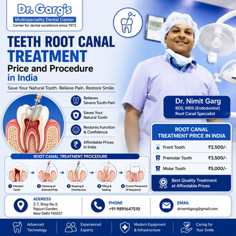 New Delhi, Dental, Teeth Root Canal Treatment Price And Procedure In India