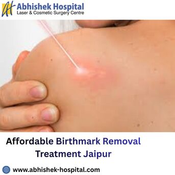 Jaipur, Health, Affordable Birthmark Removal Treatment Jaipur