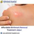 Affordable Birthmark Removal Treatment Jaipur