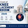 Cost Of Knee Replacement In Delhi: Complete Price Guide 2026