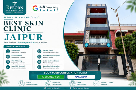Jaipur, Health & Beauty Items, INR 2500,  Best Skin Clinic In Jaipur For Summer Skin Concerns - Consult Now