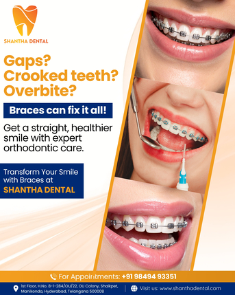 Mumbai, Dental, Dental Clinic Near Shaikpet