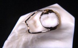Beijing, Dental, Trusted Orthodontic Dental Appliances Manufacturer In China