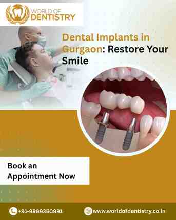 Gurgaon, Dental, Dental Implants In Gurgaon: Restore Your Smile With Advanced Technology