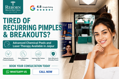 Jaipur, Health & Beauty Items, INR 2499,  Pimple Treatment In Jaipur - Get Clear Skin By Experts