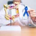 Trusted Colorectal Cancer Doctor In Noida For Treatment
