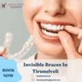 Invisible Braces In Tirunelveli | Lakshme Dental