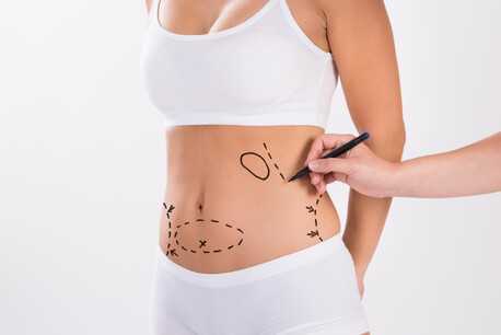 Mumbai, Health, Liposuction Surgery In Andheri &ndash; Remove Stubborn Fat Effectively