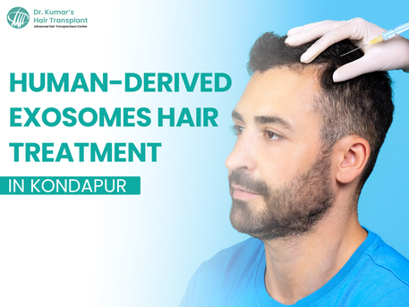Hyderabad, Health, Exosome Hair Therapy In Kondapur: A Modern Solution For Hair Loss