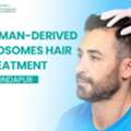 Exosome Hair Therapy In Kondapur: A Modern Solution For Hair Loss