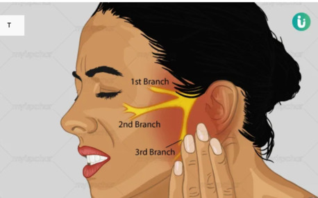 Punjab, Health, Get Trigeminal Neuralgia Homeopathic Treatment In Zirakpur