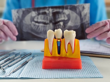 New York, Dental, Dental Implant Consultation Wilmington NC