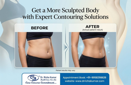 New Delhi, Health, Get A More Sculpted Body With Expert Contouring Solutions