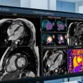 Detailed Cardiac MRI Scan In Mumbai At Picture This