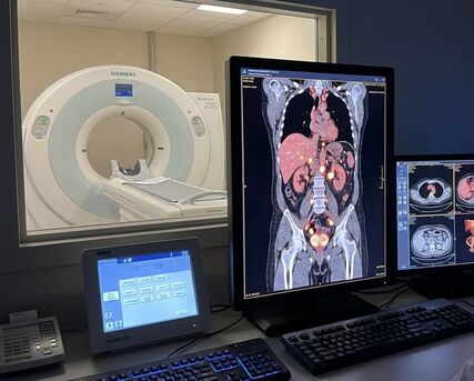 Mumbai, Medical, Accurate PSMA PET CT Scan For Prostate Cancer At Picture This