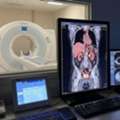 Accurate PSMA PET CT Scan For Prostate Cancer At Picture This