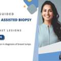 Precise Stereotactic Vacuum Assisted Breast Biopsy At Picture This Mumbai