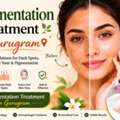 Pigmentation Treatment In Gurugram