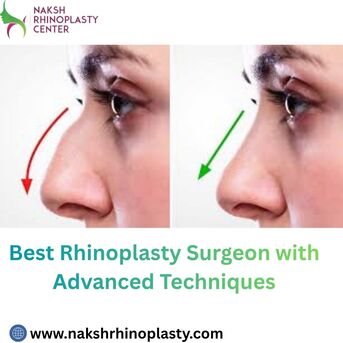 Jaipur, Health, Best Rhinoplasty Surgeon With Advanced Techniques
