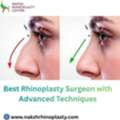 Best Rhinoplasty Surgeon With Advanced Techniques