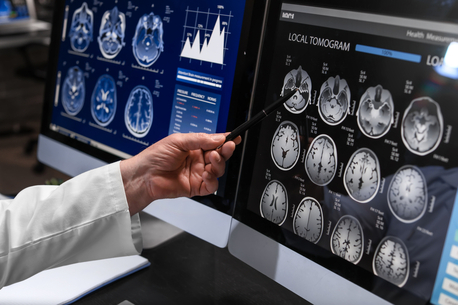 London, Health, Need A Private MRI Scan? Discover Fast & Reliable Imaging At Marris Medical UK