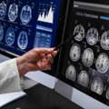Need A Private MRI Scan? Discover Fast & Reliable Imaging At Marris Medical UK