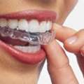 Clear Aligners And Invisalign Treatment In Thane