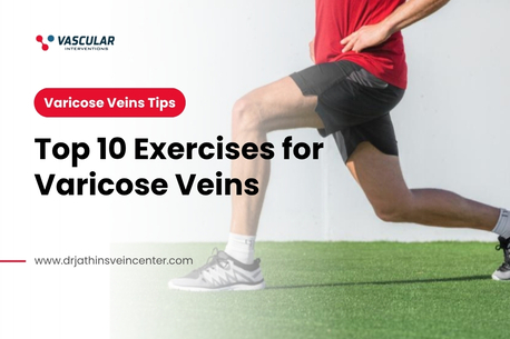 Mumbai, Health, Daily Exercise Habits That Can Improve Vein Function Naturally