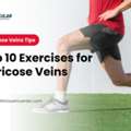 Daily Exercise Habits That Can Improve Vein Function Naturally