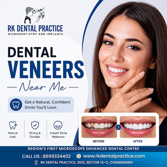 Chandigarh, Dental, Dental Veneers Near You For A Perfect Smile Transformation