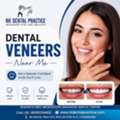 Dental Veneers Near You For A Perfect Smile Transformation