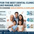 Best Dental Clinic Near AS Rao Nagar, ECIL | Smile Dental & Implant Centre