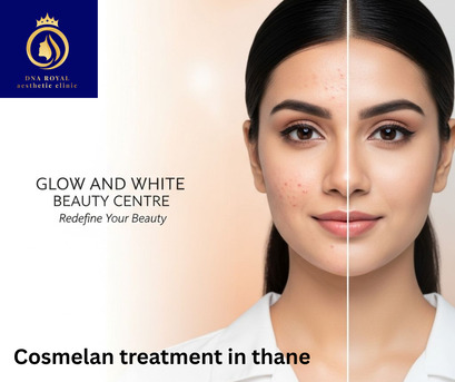 Thane, Fashion & Design, Get Flawless Skin With Cosmelan Treatment In Thane | DNA Royal.
