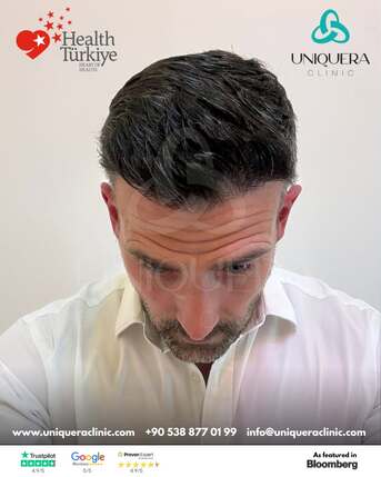 New York, Medical, Hair Transplant Surgery Turkey &ndash; UniquEra Clinic Full Package