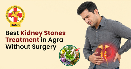 Mumbai, Health, Best Kidney Stones Treatment In Agra Without Surgery