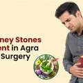 Best Kidney Stones Treatment In Agra Without Surgery