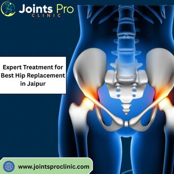Jaipur, Health, Expert Treatment For Best Hip Replacement In Jaipur