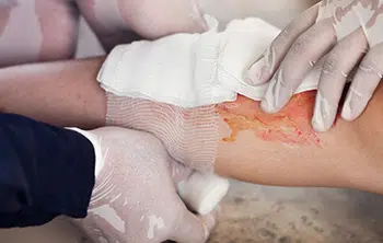 Brampton, Health, Emergency Skills Missing? First Aid Course Available Now &ndash; Limited Spaces