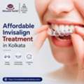 Affordable Invisalign Treatment In Kolkata