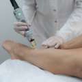 The Best Laser Hair Removal Solutions For Dark Skin In Dubai