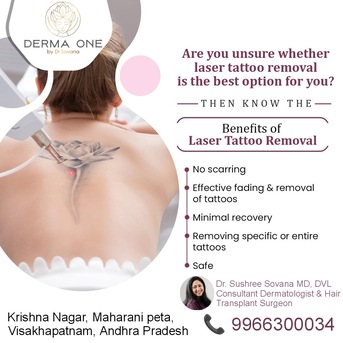 Visakhapatnam, Health, Tattoo Removal Treatment - Derma One