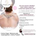 Tattoo Removal Treatment - Derma One