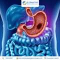 Expert Surgical Care For Gastrointestinal Cancer In Ahmedabad
