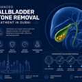 Advanced Gallbladder Stone Removal Treatment In Dubai