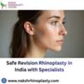Safe Revision Rhinoplasty In India With Specialists