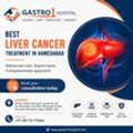 Get The Best Liver Cancer Treatment In Ahmedabad &ndash; Gastro1 Hospital