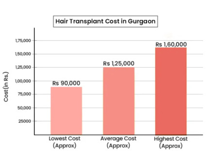 Gurgaon, Medical, Affordable Hair Transplant Cost In Gurgaon &ndash; Book Consultation