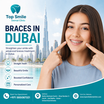 Dubai, Dental, Braces Dubai &ndash; Affordable Orthodontic Treatment At Top Smile Dental Clinic