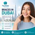 Braces Dubai &ndash; Affordable Orthodontic Treatment At Top Smile Dental Clinic